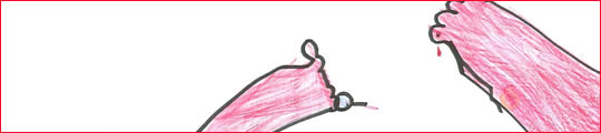 Image of a child pricking their finger